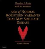atlas of normal roentgen variants that may simulate disease e book: expert consult – enhanced online features and print 9th edition, kindle edition