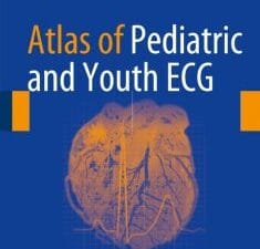 Atlas of Pediatric and Youth ECG