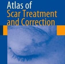 atlas of scar treatment and correction