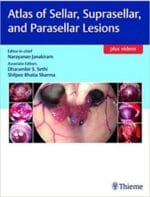 atlas of sellar, suprasellar and parasellar lesions