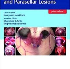atlas of sellar, suprasellar and parasellar lesions