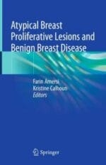 atypical breast proliferative lesions and benign breast disease