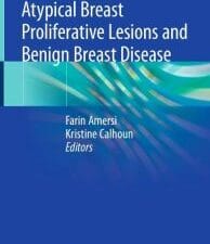 atypical breast proliferative lesions and benign breast disease