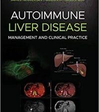 autoimmune liver disease: management and clinical practice 1st edition