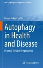 autophagy in health and disease potential therapeutic approaches