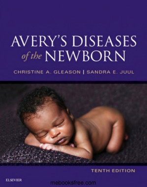 avery’s diseases of the newborn 10th edition