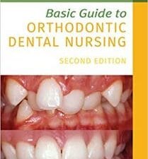 Basic Guide to Orthodontic Dental Nursing (Basic Guide Dentistry Series) 2nd Edition