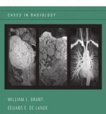 body mri cases