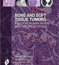 bone and soft tissue tumours: a multidisciplinary review with case presentations 1st edition