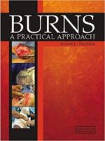 burns (a practical approach to immediate treatment and long term care) 1st edition