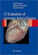 ct evaluation of coronary artery disease