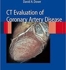 ct evaluation of coronary artery disease