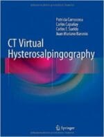 ct virtual hysterosalpingography