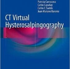 ct virtual hysterosalpingography