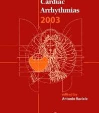 Cardiac Arrhythmias 2003: Proceedings of the 8th International Workshop on Cardiac Arrhythmias