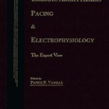 Cardiac Arrhythmias, Pacing & Electrophysiology: The Expert View