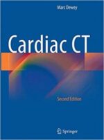 Cardiac CT