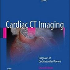 Cardiac CT Imaging: Diagnosis of Cardiovascular Disease Edition 2