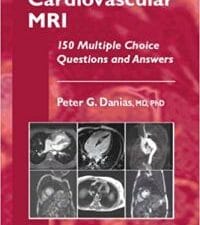 Cardiovascular MRI: 150 Multiple-Choice Questions and Answers (Contemporary Cardiology) 2008th Edition