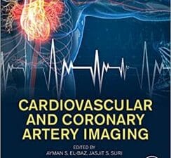 Cardiovascular and Coronary Artery Imaging: Volume 1 1st Edition
