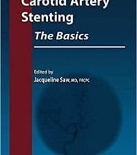 Carotid Artery Stenting: The Basics