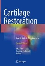 cartilage restoration: practical clinical applications 2nd edition