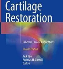 cartilage restoration: practical clinical applications 2nd edition