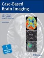 case based brain imaging (2nd edition)