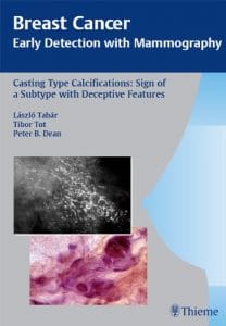 casting type calcifications: sign of a subtype with deceptive features