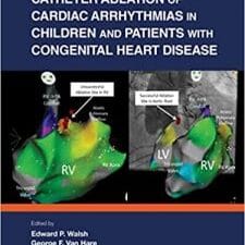 Catheter Ablation of Cardiac Arrhythmias in Children and Patients with Congenital Heart Disease 1st Edition