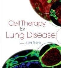 cell therapy for lung disease