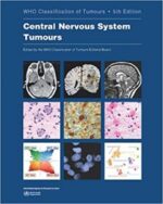 central nervous system tumours: who classification of tumours: 6