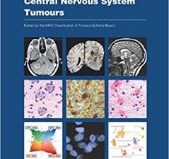 central nervous system tumours: who classification of tumours: 6