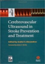 Cerebrovascular Ultrasound in Stroke Prevention and Treatment 1st Edition