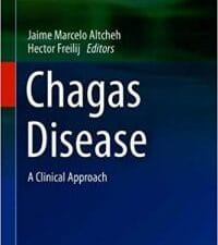 chagas disease: a clinical approach