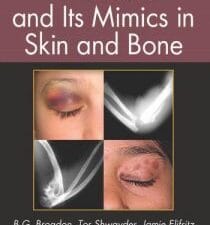 Child Abuse and its Mimics in Skin and Bone