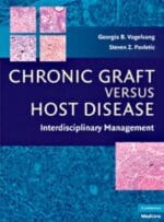 chronic graft versus host disease: interdisciplinary management