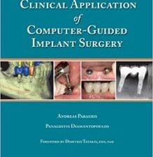 Clinical Application of Computer-Guided Implant Surgery
