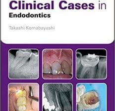 Clinical Cases in Endodontics