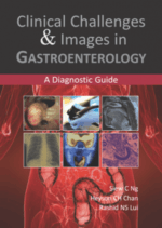 clinical challenges & images in gastroenterology : a diagnostic guide