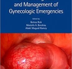 Clinical Diagnosis and Management of Gynecologic Emergencies 1st Edition