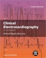 Clinical Electrocardiography: A Textbook 4th Edition