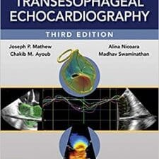 Clinical Manual and Review of Transesophageal Echocardiography, 3/e 3rd Edition