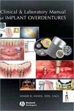 clinical and laboratory manual of implant overdentures