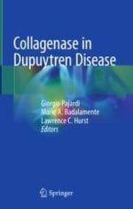 collagenase in dupuytren disease
