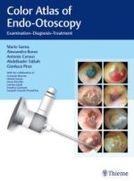 color atlas of endo otoscopy: examination diagnosis treatment 1st edition