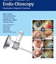 color atlas of endo otoscopy: examination diagnosis treatment 1st edition