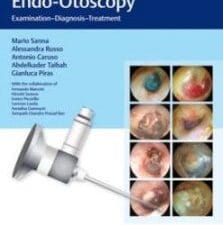 color atlas of endo otoscopy : examination diagnosis treatment
