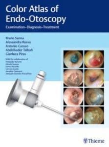 color atlas of endo otoscopy : examination diagnosis treatment