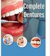 Complete Dentures